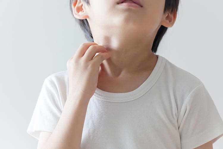 アレルギーのイメージ写真